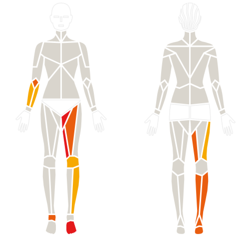 SMC Alkmaar - Thermografie body